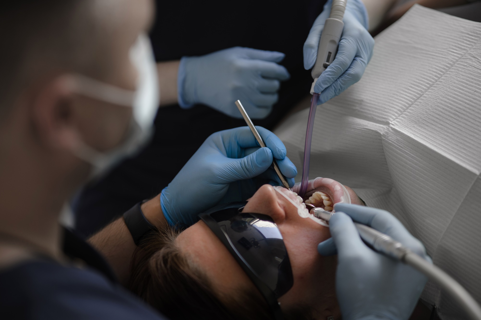 Лечение пародонтита и пародонтоза