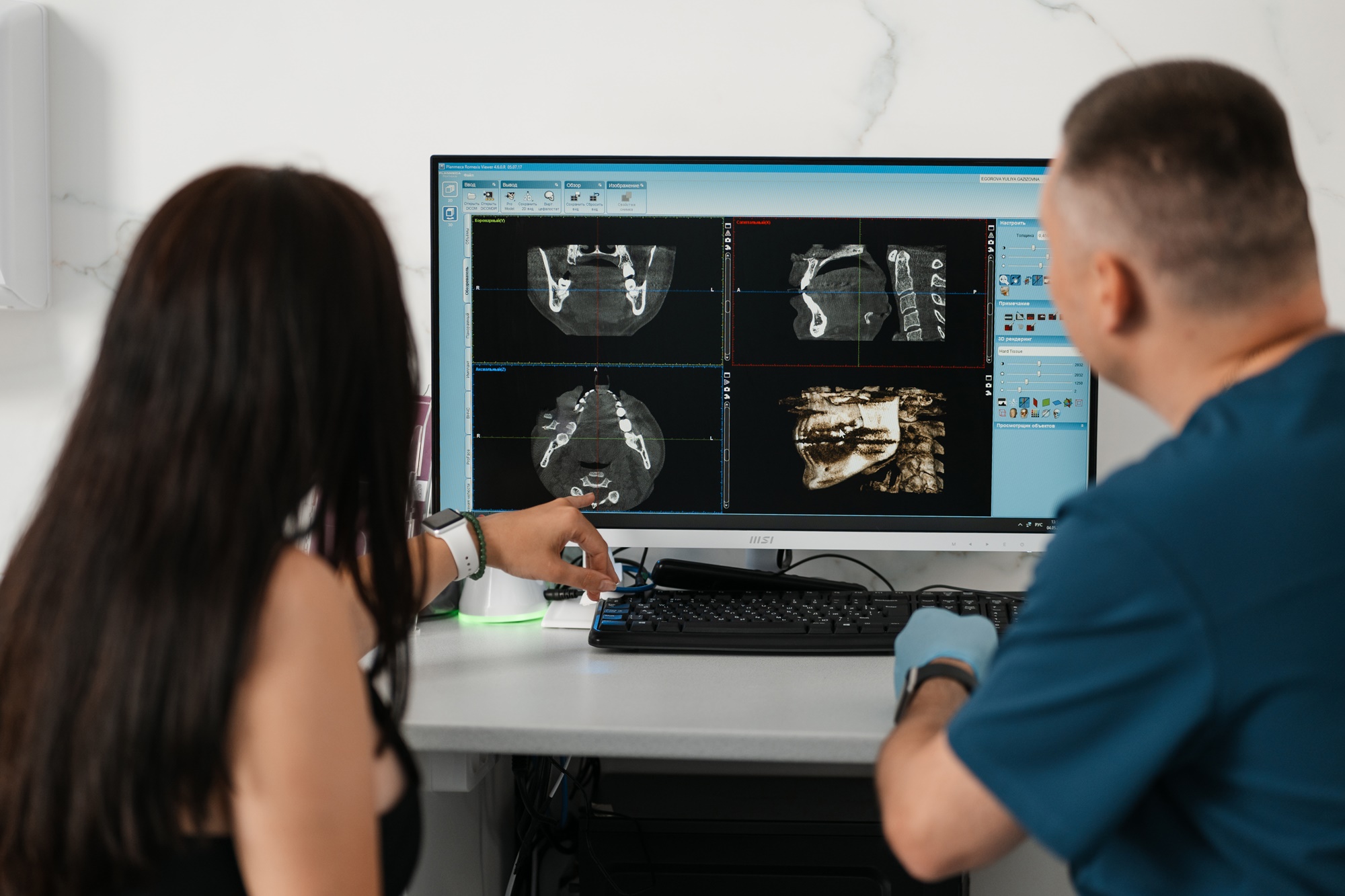 Имплантация передних зубов