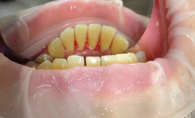 Профессиональная гигиена полости рта