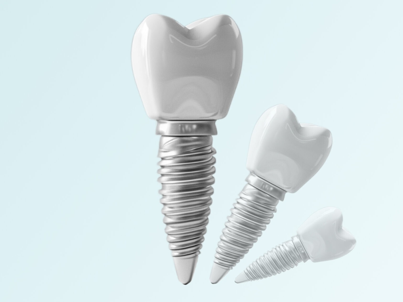 Установка импланта Osstem (Южная Корея)