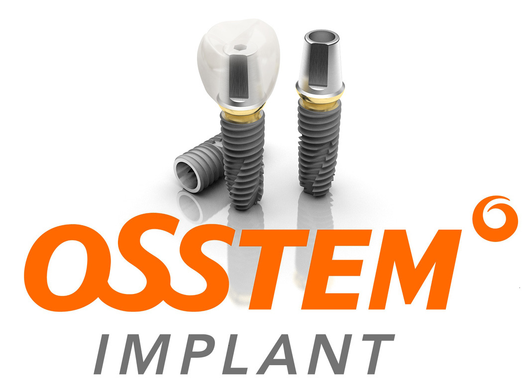 Преимущества имплантов OSSTEM